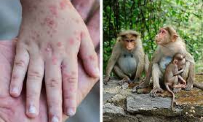 Variola maimuţei: OMS declară urgență globală de sănătate publică, cel mai înalt nivel de alertă