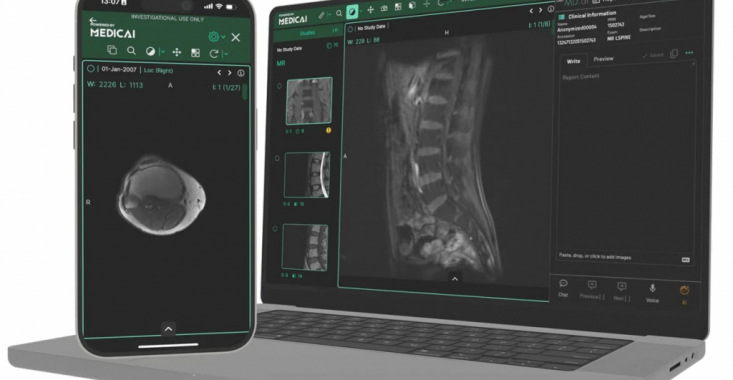 Cum arată viitorul radiologiei cu “AI (Artificial Intelligence) Co-Pilot” de la Medicai