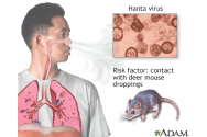  Bolnav cu hantavirus, adus de la Neamț. Este în stare gravă