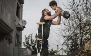 Italia, emoționată de fotografia unui tată ce își ține în brațe copilul născut fără mâini și fără picioare