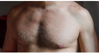 Mans-chest-and-neck-1200x628-facebook-1200x628