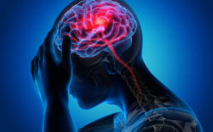 Semnele care prevestesc apariția unui atac cerebral