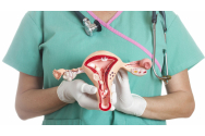  Campanie de testare a cancerului de col uterin, la Bârlad