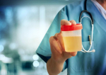 Cum interpretezi analizele de urină. Care sunt modificările anormale