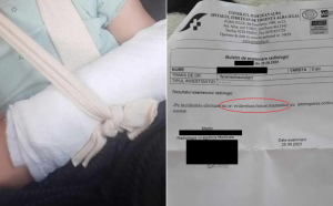 O fetiță de 5 ani a ajuns la spital cu mâna ruptă. Medicii din Alba nu și-ar fi dat seama și i-au recomandat unguent pentru durere