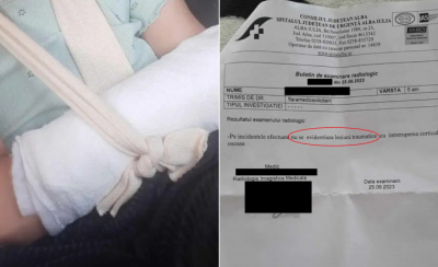 O fetiță de 5 ani a ajuns la spital cu mâna ruptă. Medicii din Alba nu și-ar fi dat seama și i-au recomandat unguent pentru durere
