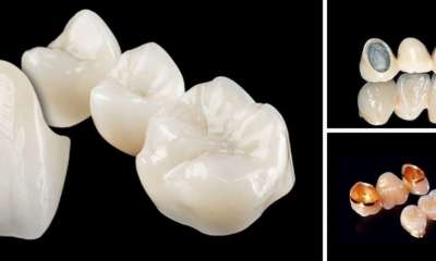  Care este diferenta dintre lucrarile dentare metalo ceramice si cele din zirconiu?